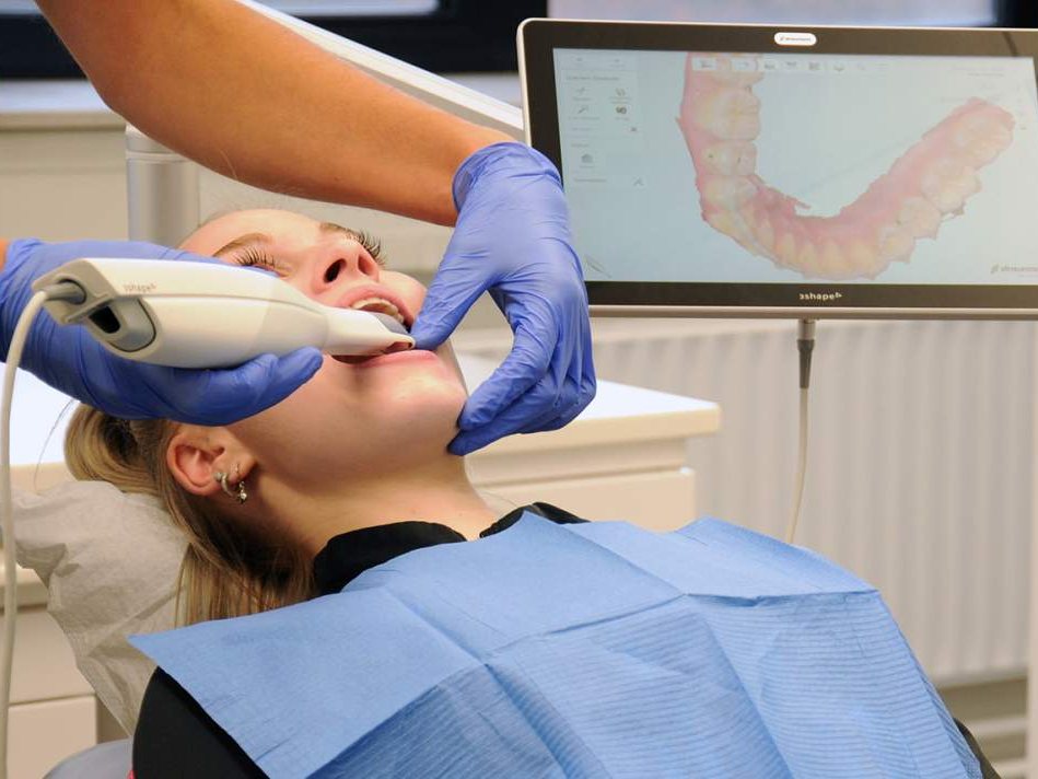 Digitale scan van het gebit met de 3Shape-scanner